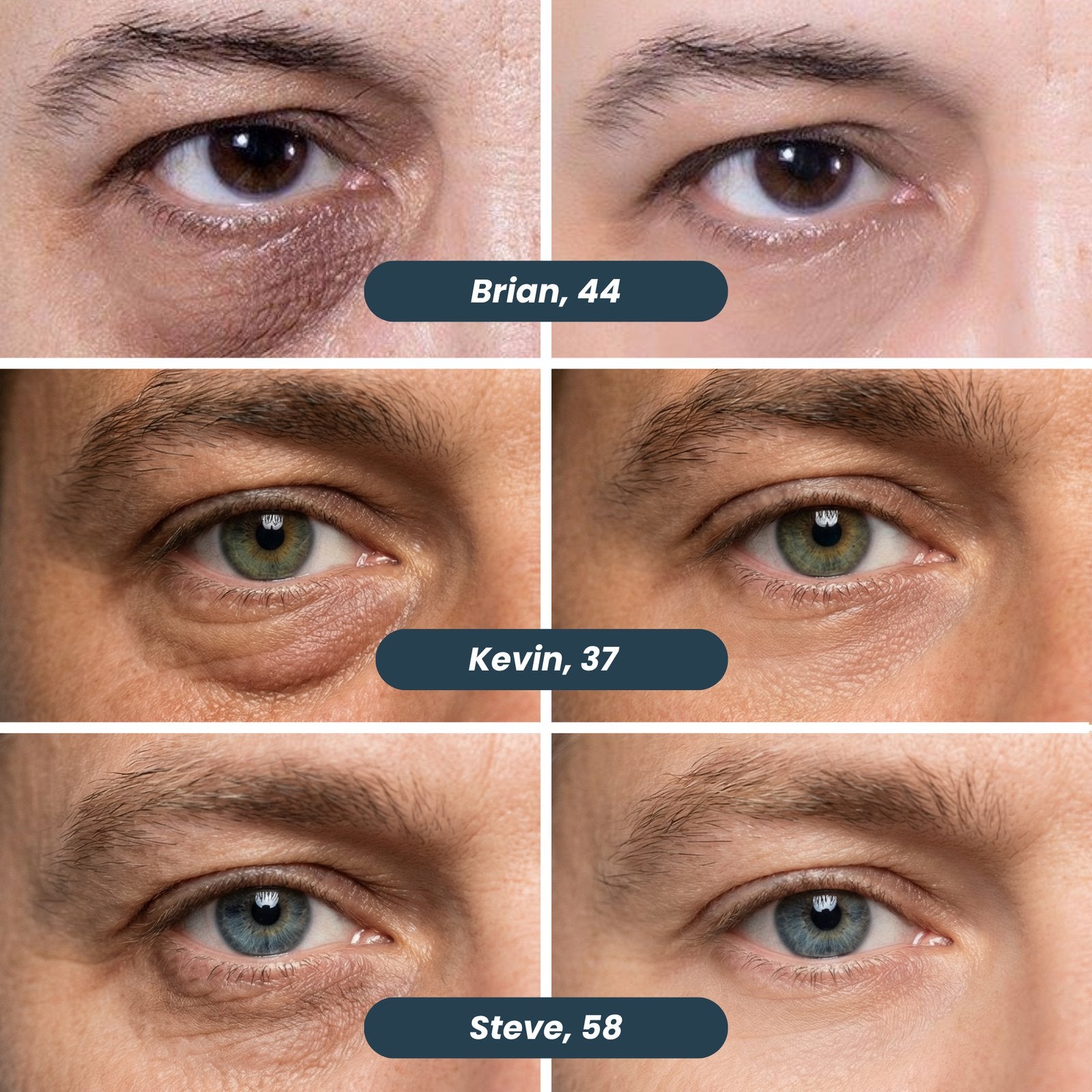 Microneedle Patches | New Generation